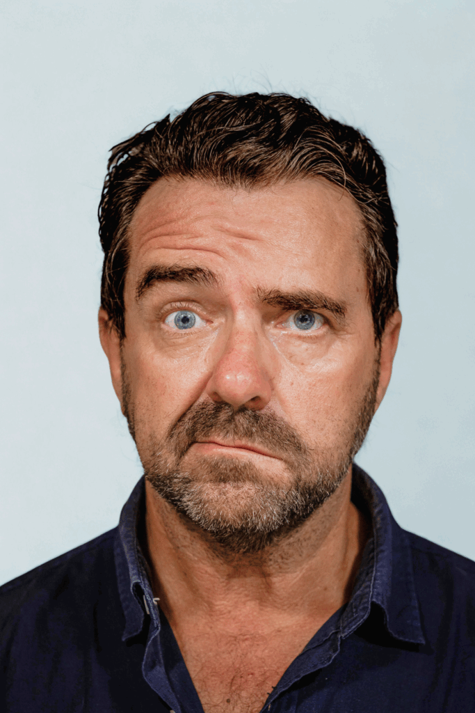 man with bell's palsy vs stroke