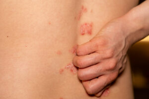 Provider examining a rash on a patient's forearm in urgent care