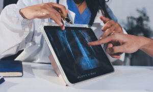 PA reviewing a plain film x-ray before the radiology read comes back